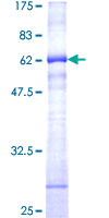 12.5% SDS-PAGE Stained with Coomassie Blue.
